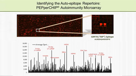 Webinar: Identification of Autoreactive B Cells - From High-Throughput Epitope Analysis to Tetramer Development