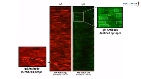  Tutorial: Peptide microarray immunoassay for diagnostic epitope discovery